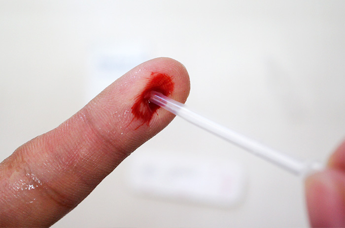 血をスポイトで吸う
